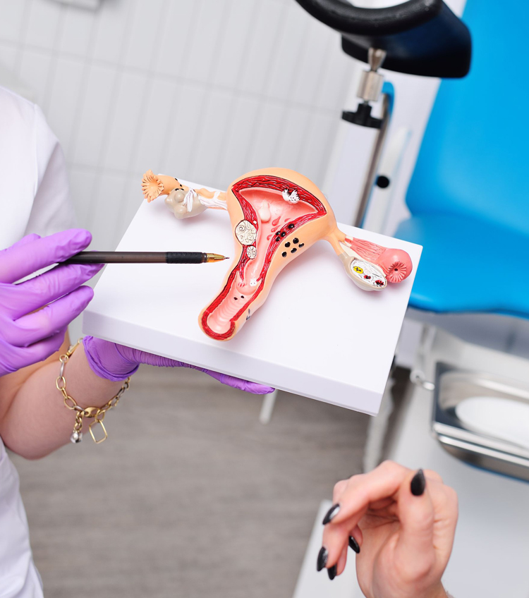 Polikistik Over Sendromuna Fonksiyonel Yaklaşım