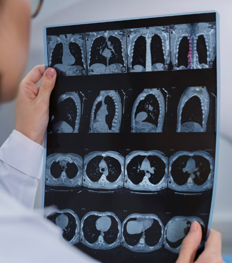 Magnetic Resonance Imaging (MRI) of the Breast