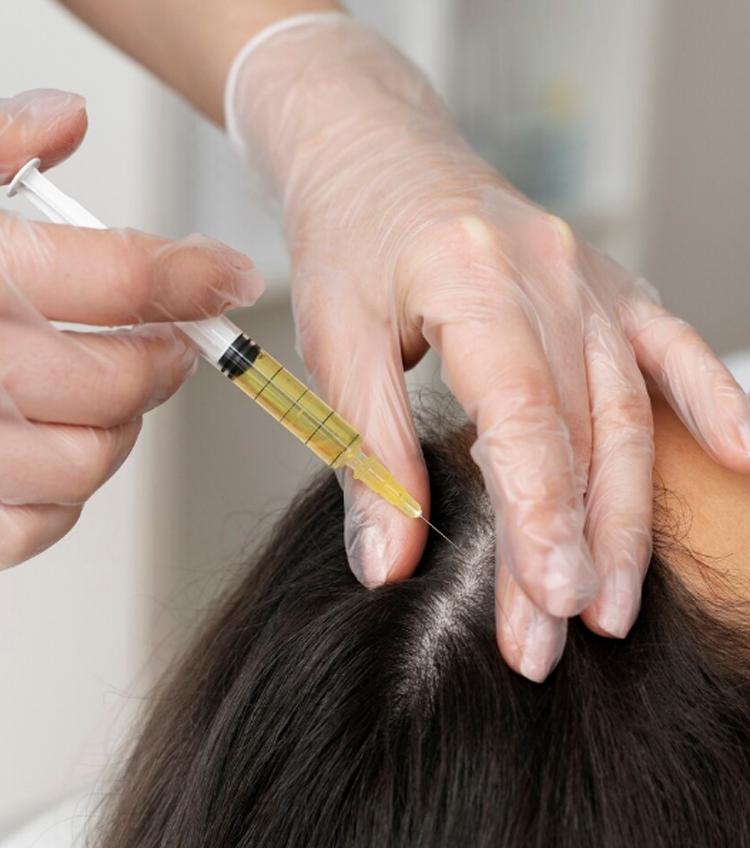 Hair Loss Treatments (PRP, Mesotherapy, Autologous Micrografting)