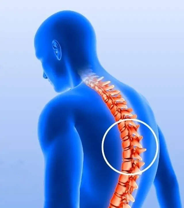 Vertebroplasti ve Sementoplasti (Ameliyat Çökme Kırığı Tedavileri)