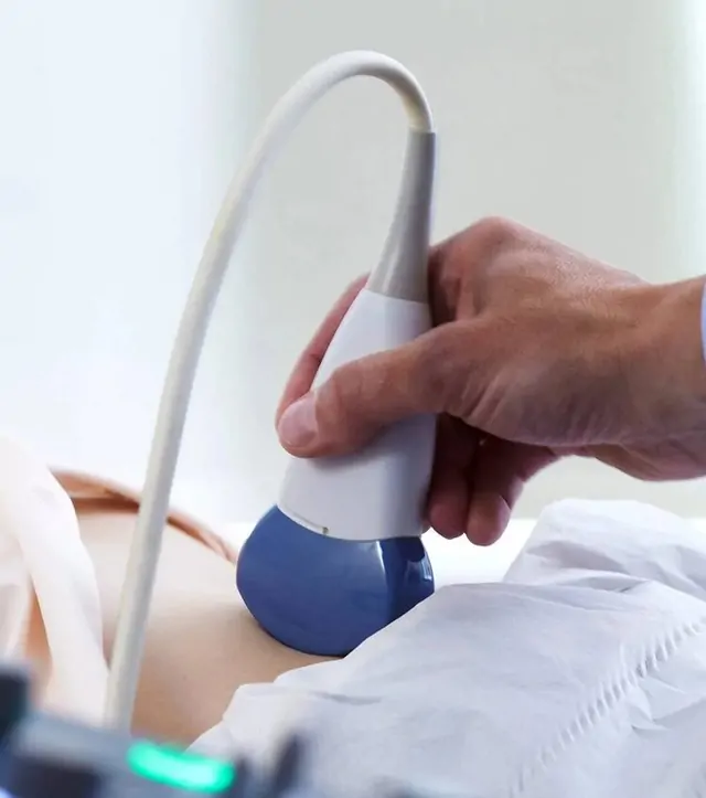 Fokuslanmış Ultrason (HIFU) İle Fibroadenom Tedavisi