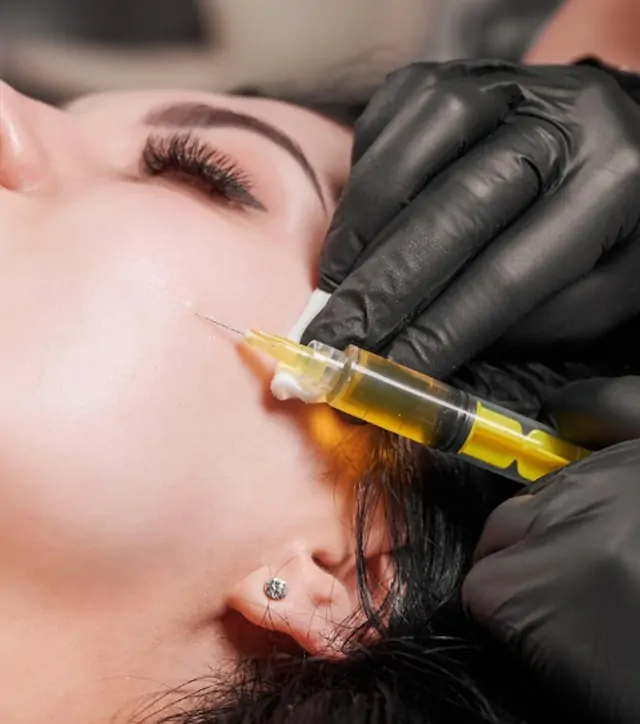 PRP and Sanakin Treatment (Enriched PRP)